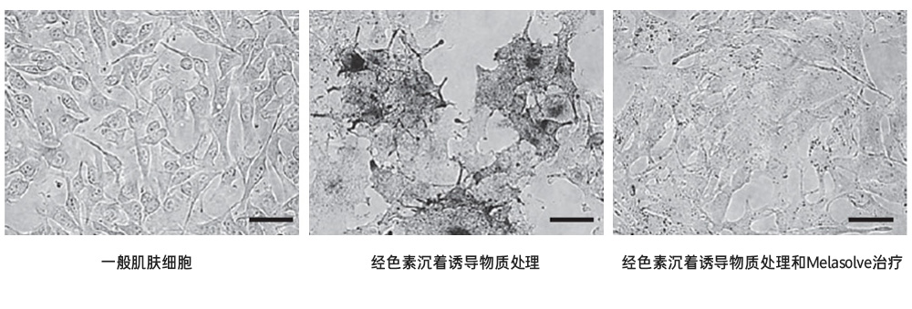 Melasolve:为安全美白献力