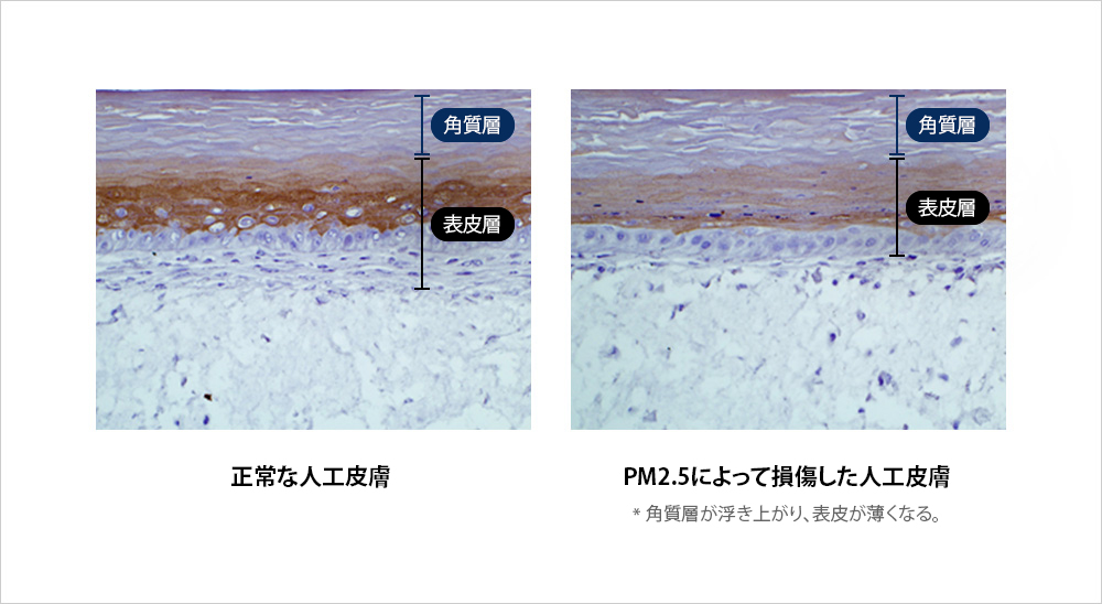 アンチポリューション技術